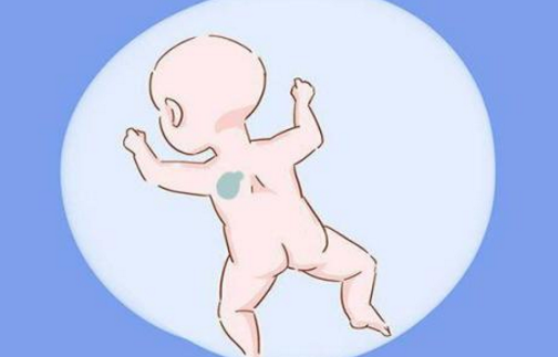 胎记是怎么形成的 这三类胎记或暗示疾病信号_拓诊卫生资讯