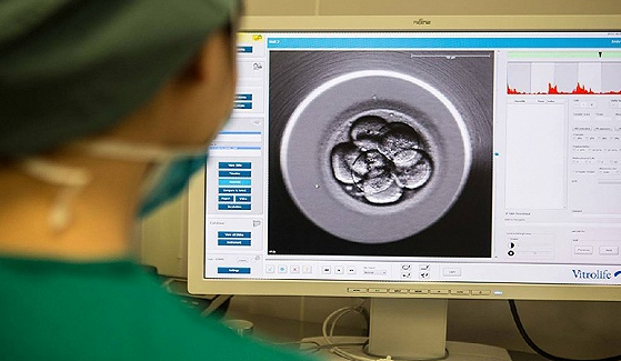 世界首例“卵母细胞内注射自体骨髓细胞线粒体”获得临床妊娠