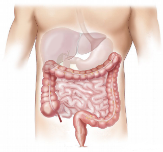 大肠息肉都会有哪些症状表现出来？