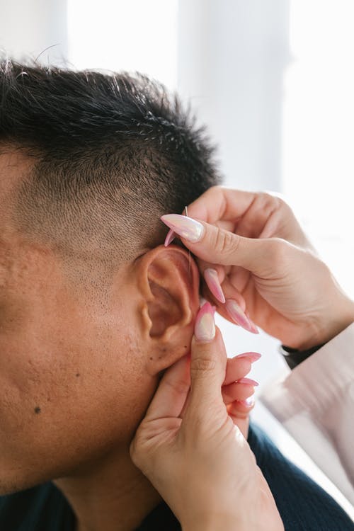 针灸美容之耳针法