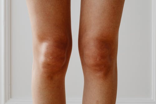 应怎样预防膝关节韧带损伤？