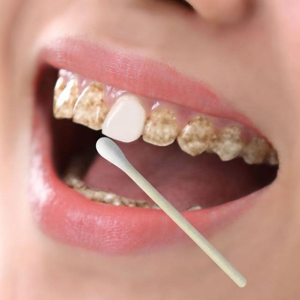 刷牙前只用1个小方法，牙黄、口臭全部消失，从此告别大黄牙_拓诊卫生资讯