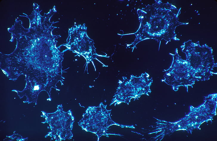 斯坦福研究人员开发的“诱饵分子”能阻止癌细胞的扩散