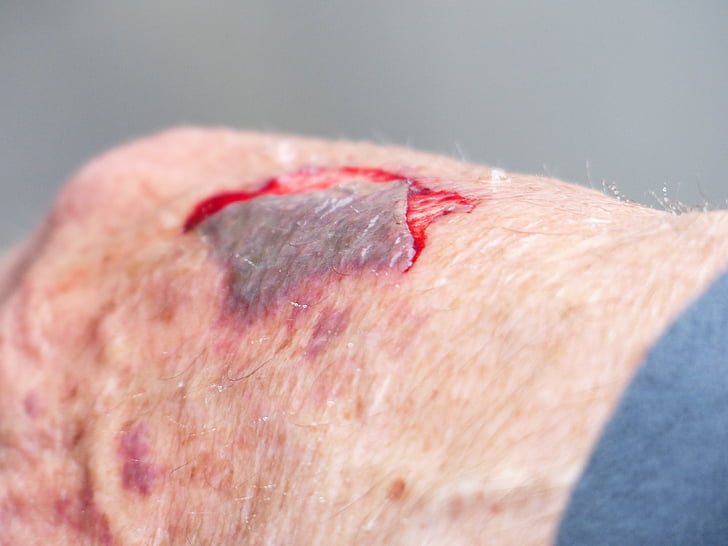 hand-injury-wound-blood-preview.jpg
