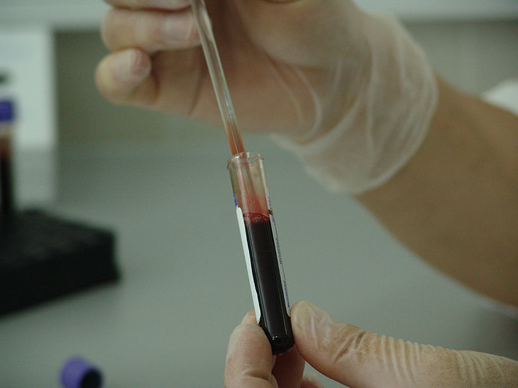 blood-vial-analysis-laboratory-preview.jpg